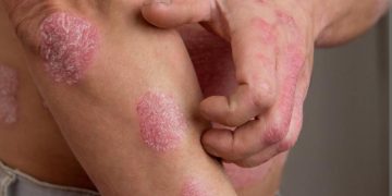 Moras Lahadaet  Kontinua Aumenta iha TL